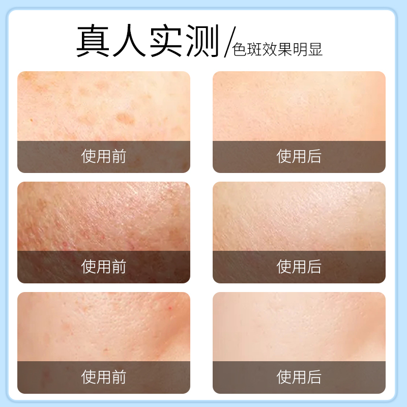 cb美白~淡斑面膜~主圖-3.jpg