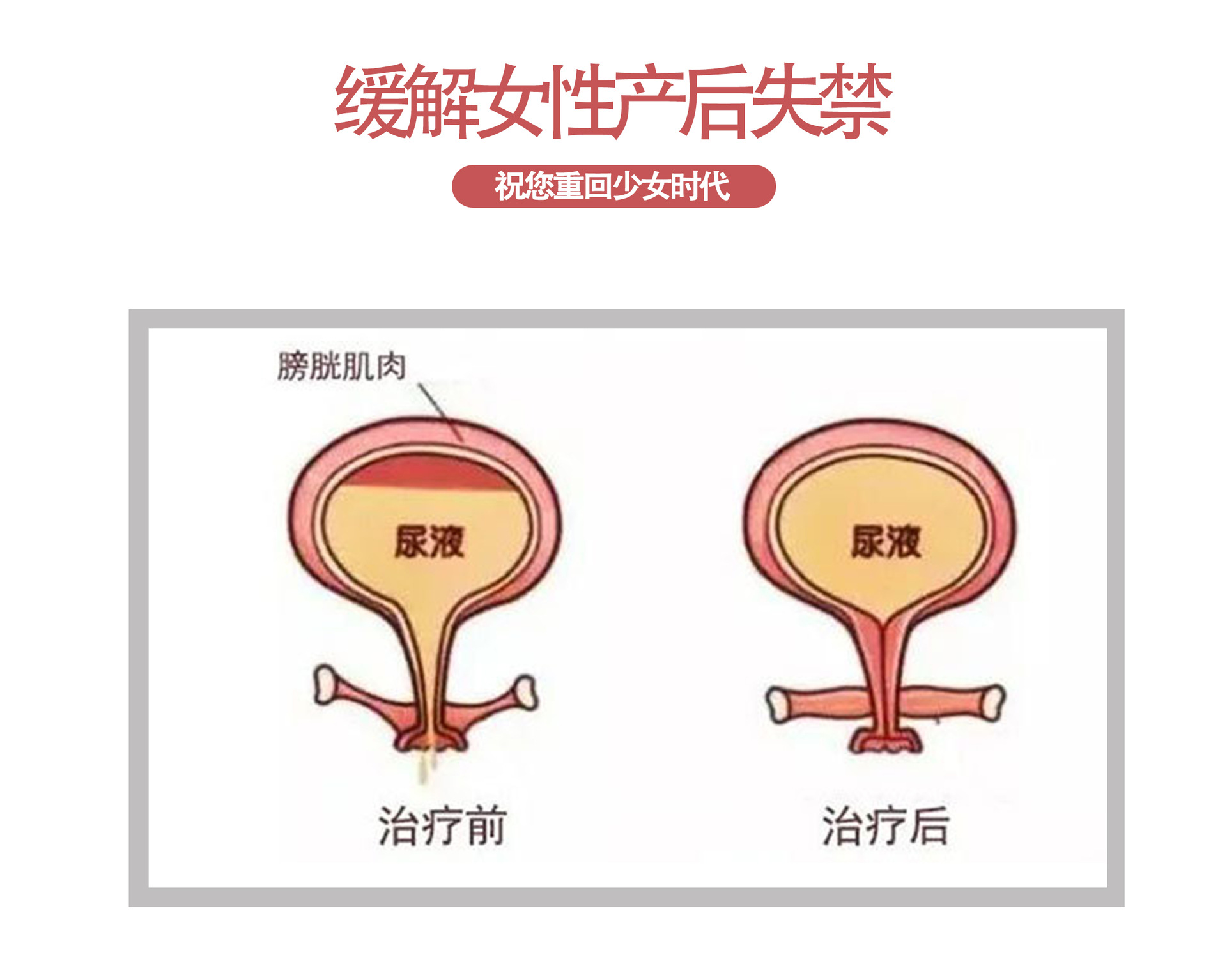 5-详情图.jpg