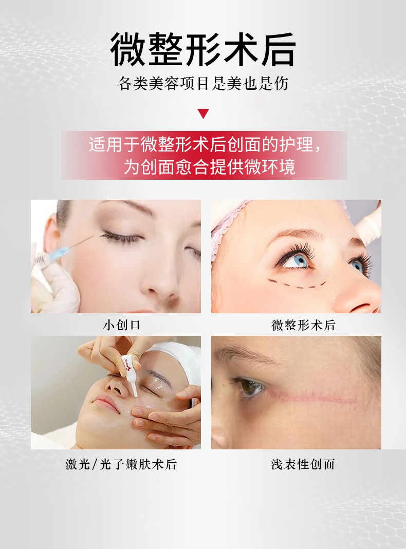 菲诗魔法重组III型胶原蛋白敷贴（眼膜）详情_04.jpg