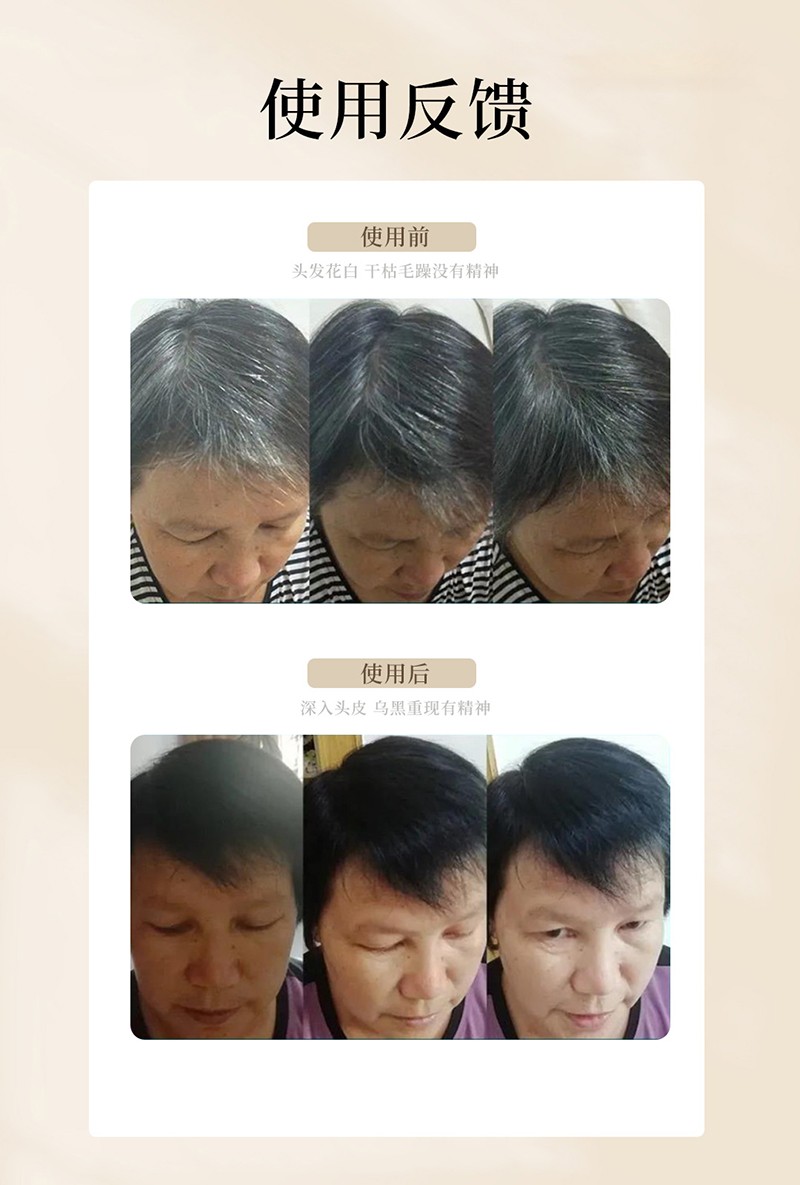 乌珠草本黑发保健液8.jpg