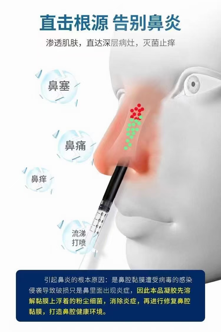 鼻炎喷剂源头工厂,上百款自主研发配方满足你的需求