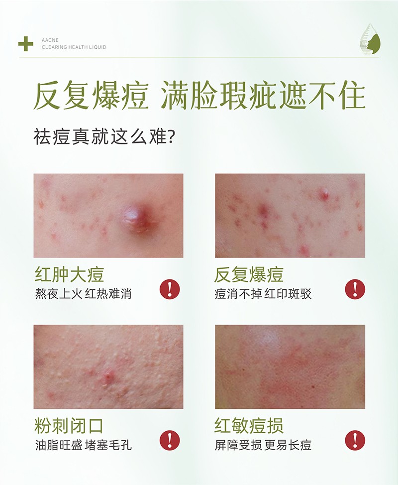 痘清保健液_02.jpg