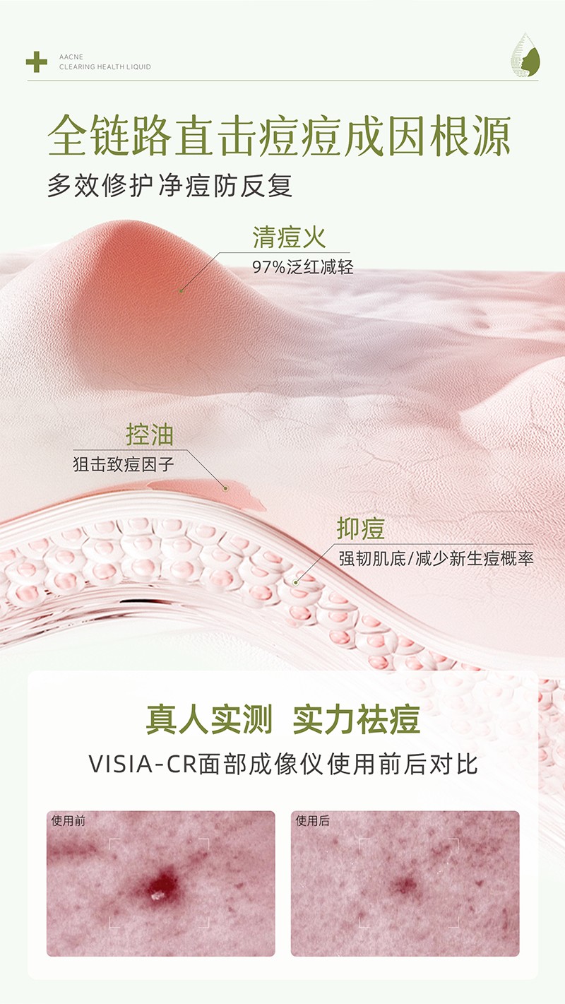 痘清保健液_05.jpg