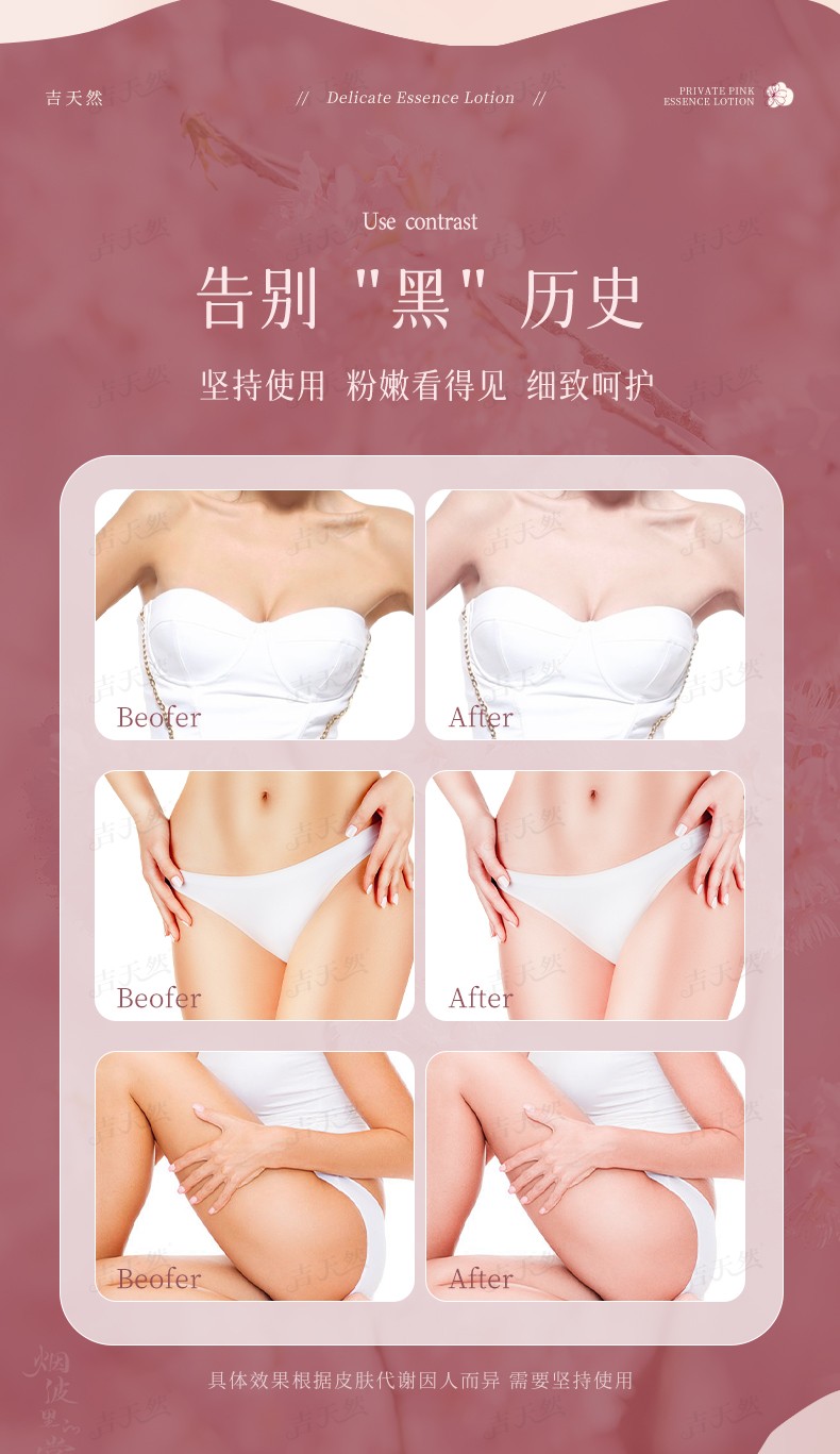 详情页_06.jpg