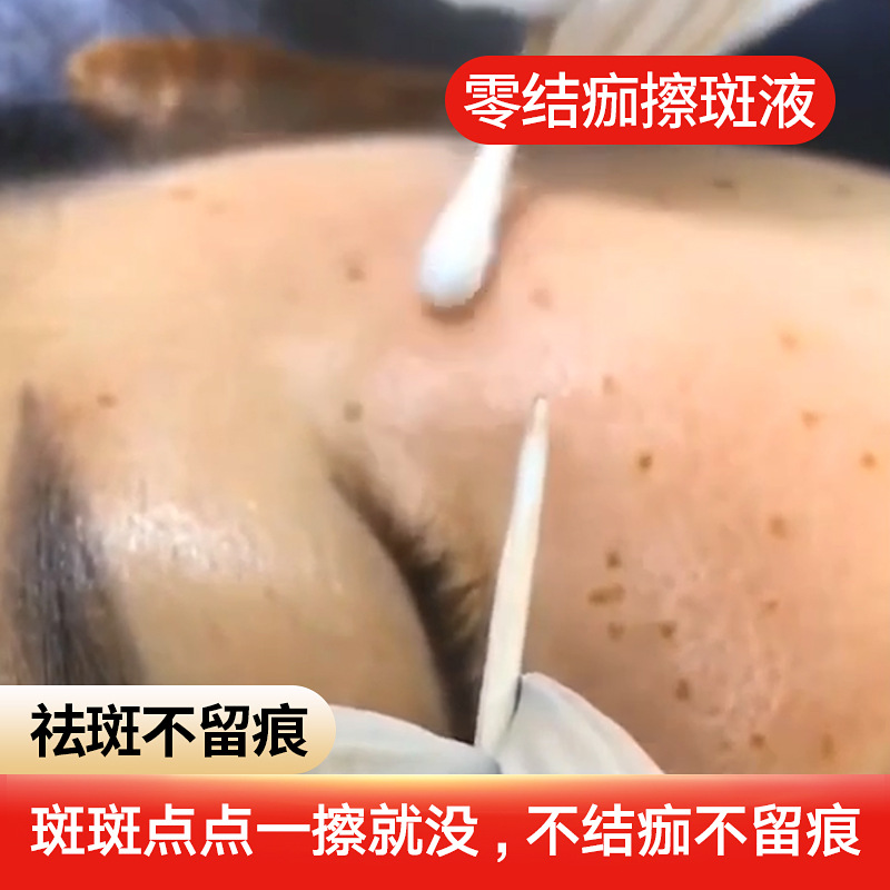 擦斑液 贴牌OEM/ODM