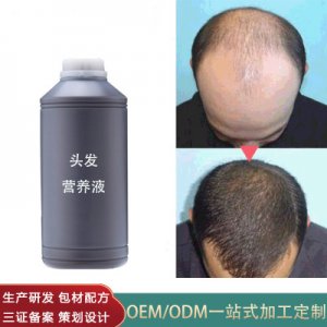 何首乌头皮营养液代加工贴牌OEM/ODM