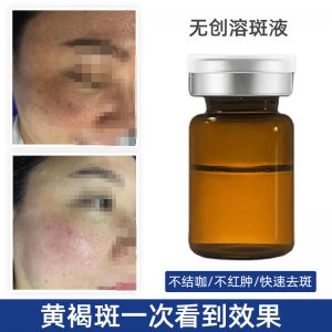 黑色素淡化眞皮斑融斑液 贴牌OEM/ODM