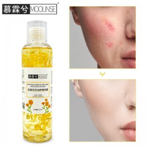 慕霖兮金盏花爽肤水OEM/ODM代加工