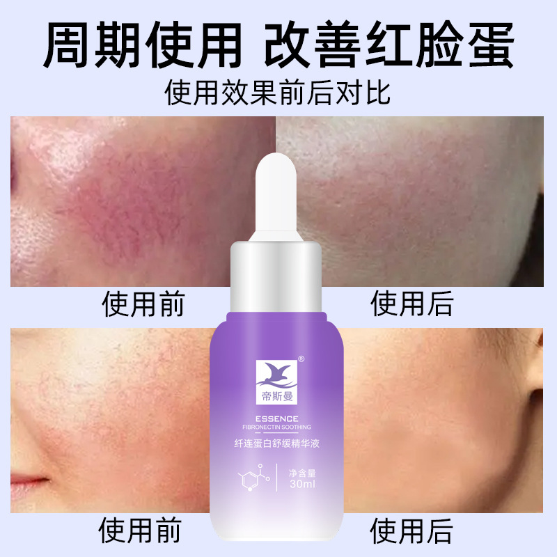 去除红血丝增厚角质层改善敏感肌肤修复脸部泛红高原红化妆品批发OEM代加工