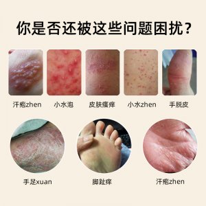 皮肤抑菌膏OEM代加工源头工厂