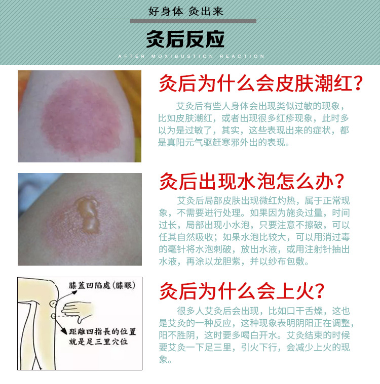 艾条 温灸艾条 艾段艾条 厂家批发艾草陈纯艾医用艾灸条柱保健