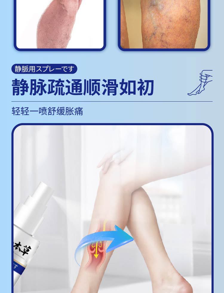 云南本草静脉舒喷剂静脉腿部青筋凸起曲张清金抑菌液蚯蚓腿血管肿