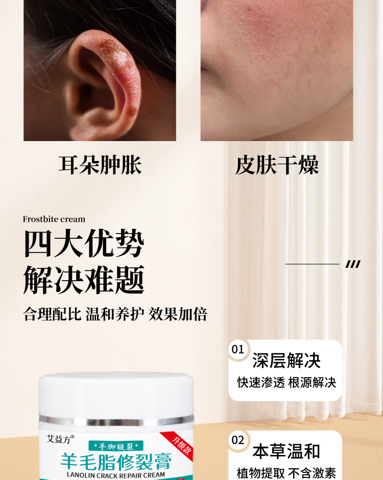 羊毛脂手足修裂膏裂口脱皮疮冻膏修护滋润护手霜冻裂皲裂膏