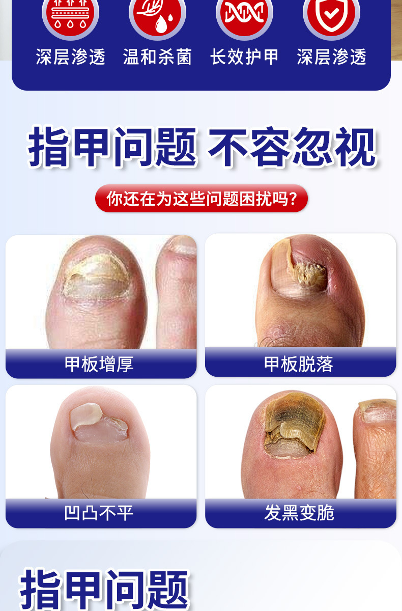 国药世家灰甲贴修复贴护理脚趾甲软甲嵌甲增厚型亮甲沟修护贴