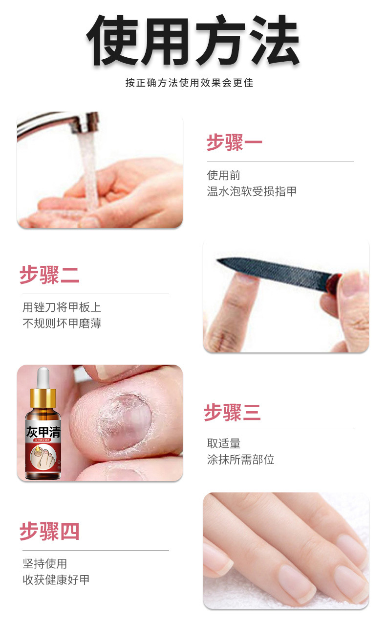 雪槐灰甲清指甲护理脱甲膏软甲草本抑菌液足部护理厂家直销灰指甲