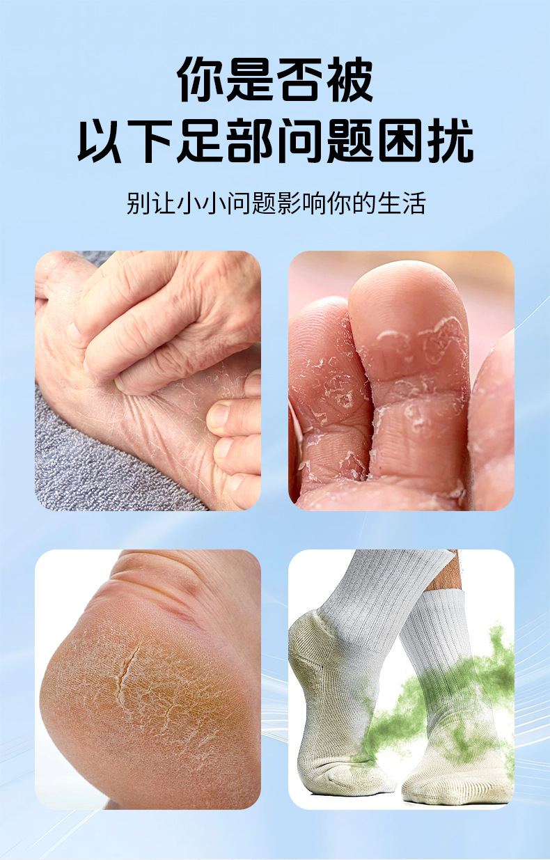 苗家郎中脚臭喷剂厂家批发脚臭脚汗喷雾脚丫喷剂止汗脱皮苗药乳膏