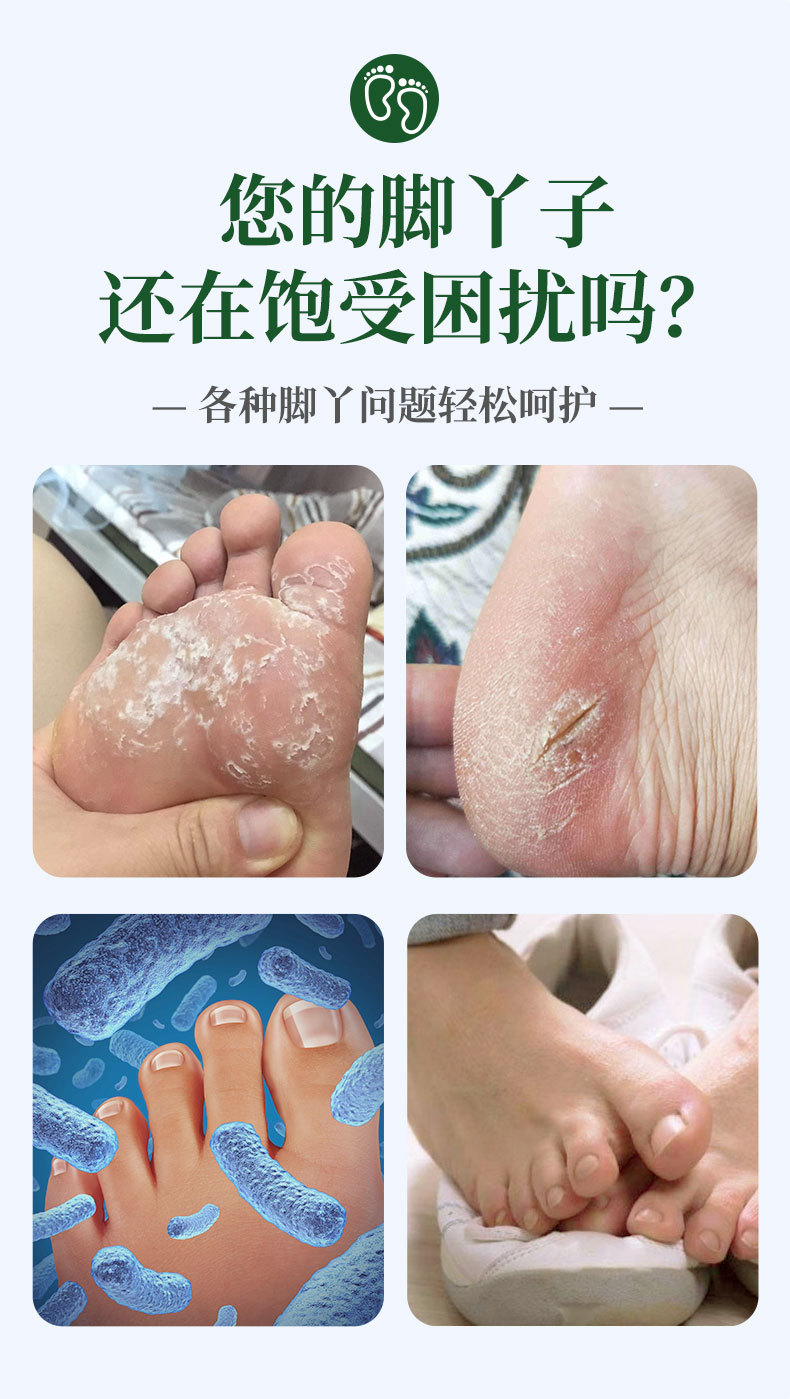 云南本草狼毒膏厂家批发脚汗脚痒脚臭乳膏足部护理止痒膏代发抑菌