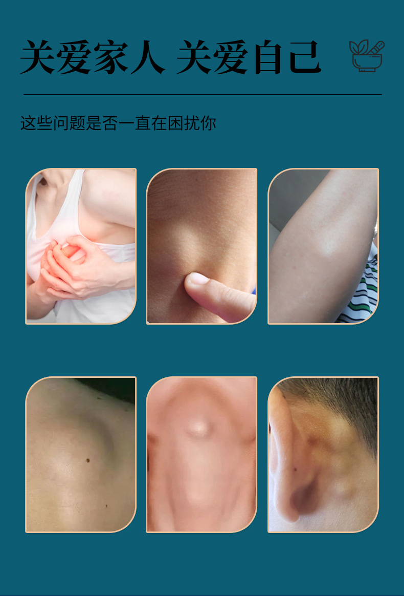 云南本草结节泡脚凝珠浓缩免熬煮熏蒸足浴原液二十八味泡脚包药浴