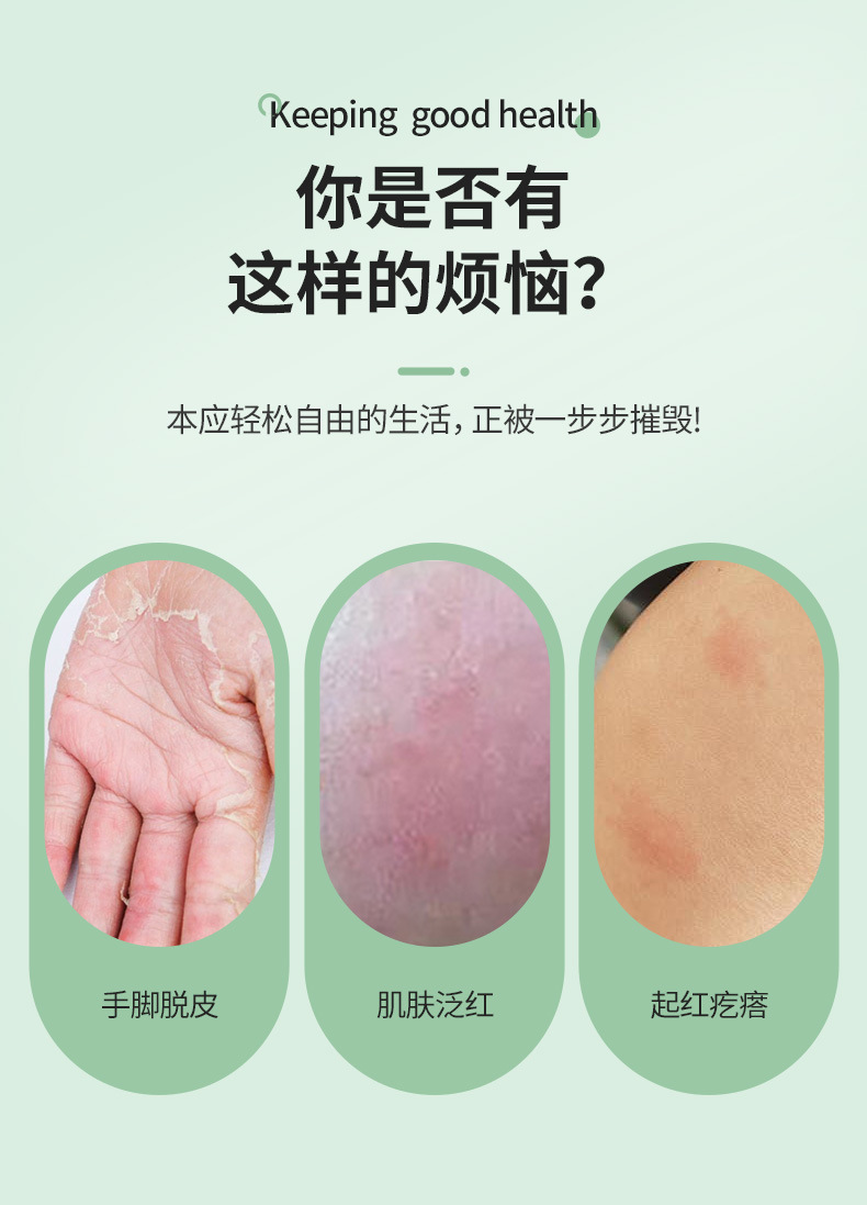 艾草小黄油20g家用艾叶保健膏棚源坊肤霸乳膏皮肤外用护理膏批发