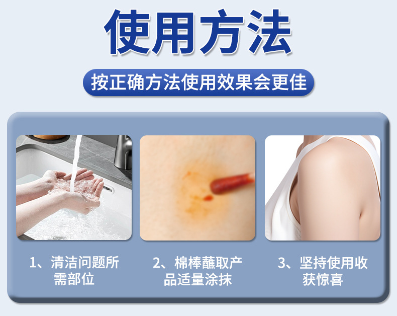 雪槐茧尤清肉刺脚垫瘊子鸡眼2024新品 克疣液老茧死皮草本抑菌液