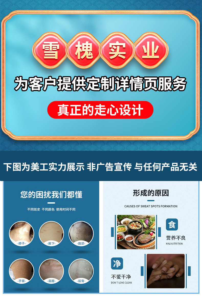 苗丹朱汗斑净喷剂花斑藓去汗露皮肤斑身体护理草本白斑液止汗斑露