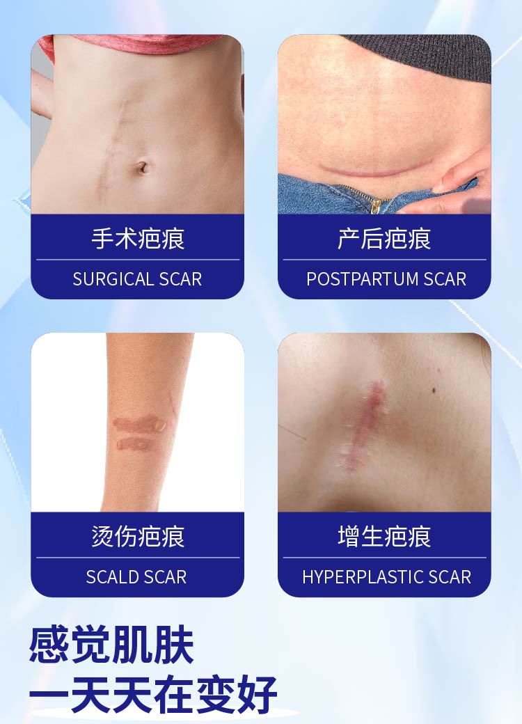 疤纹无痕膏滚珠凝胶疤痕增生手术疤腿疤淡缓解舒缓产后疤批发定制