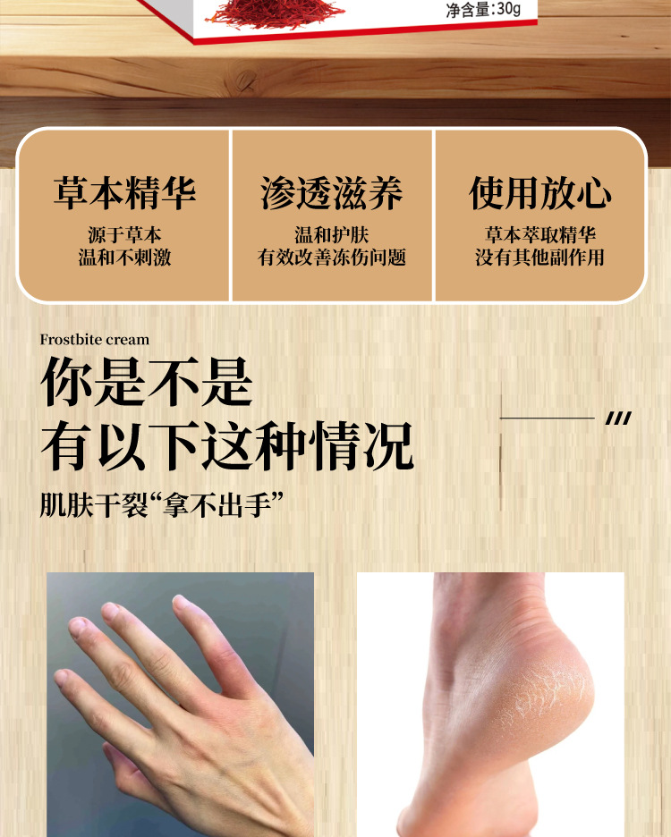 冻疮蛇油膏手足防裂修护手霜防冻膏裂可宁皲裂膏润肤批发一件代发
