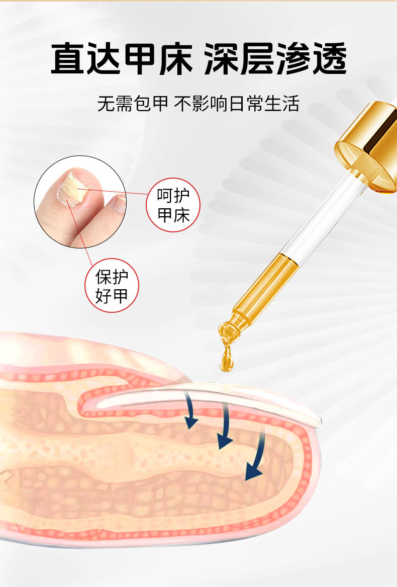 同仁堂灰甲宁滴剂凤仙花足部护理脱甲精油灰指甲去甲膏药水和甲膏