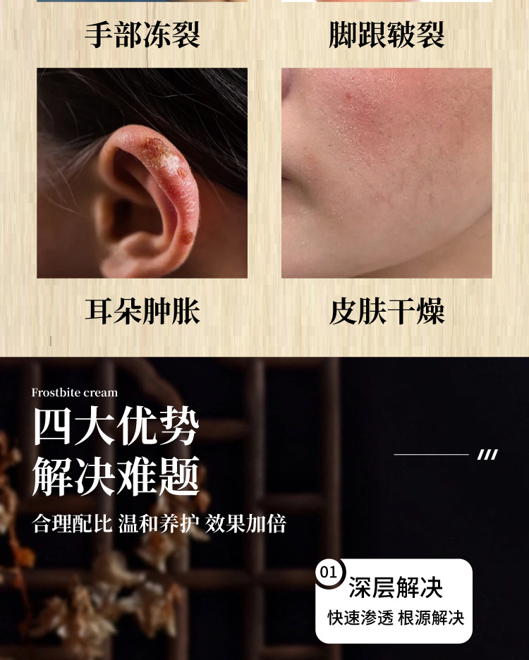 冻疮蛇油膏手足防裂修护手霜防冻膏裂可宁皲裂膏润肤批发一件代发