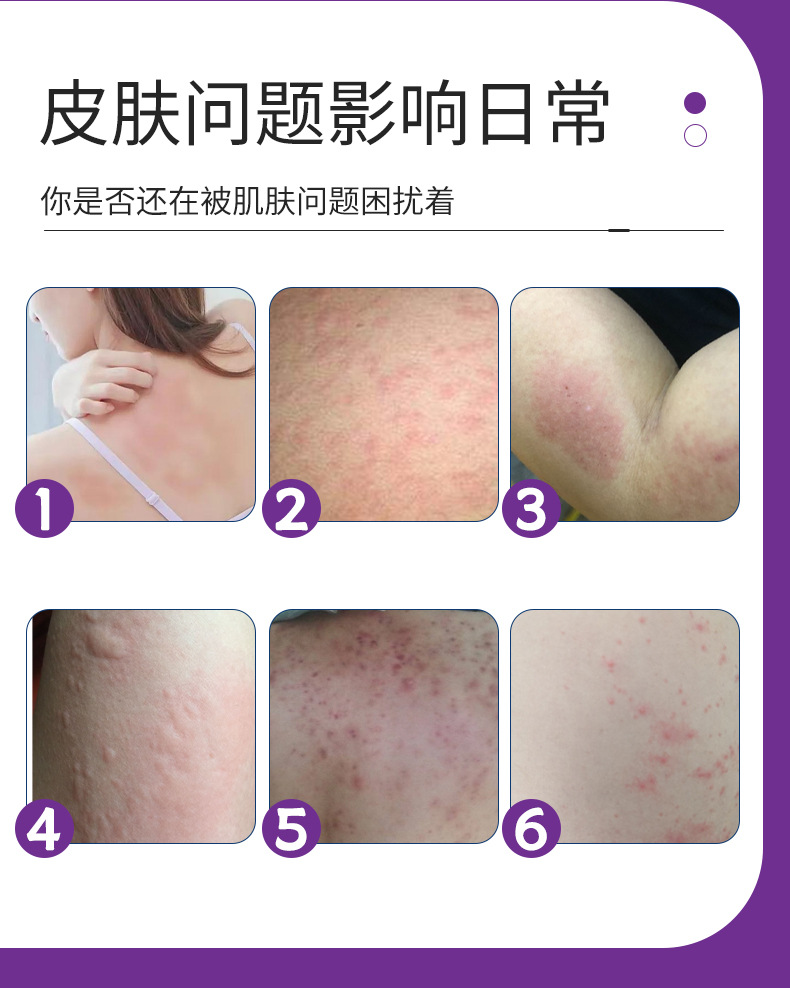 同仁堂紫花地丁膏皮肤外用草本涂抹乳膏紫草膏全家通用止痒紫金膏