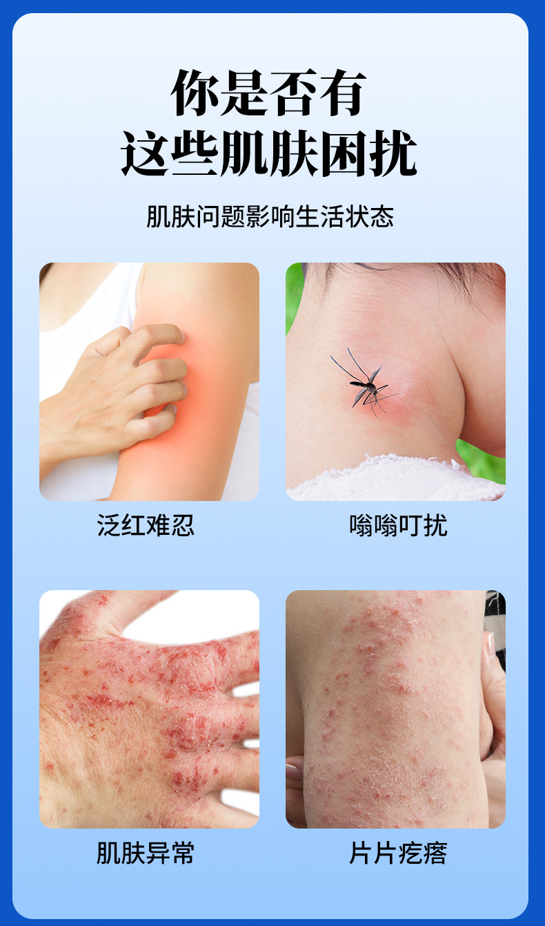 扁鹊世医湿毒皮清止痒膏抑菌膏湿毒清苗药草本乳膏外用皮肤止痒