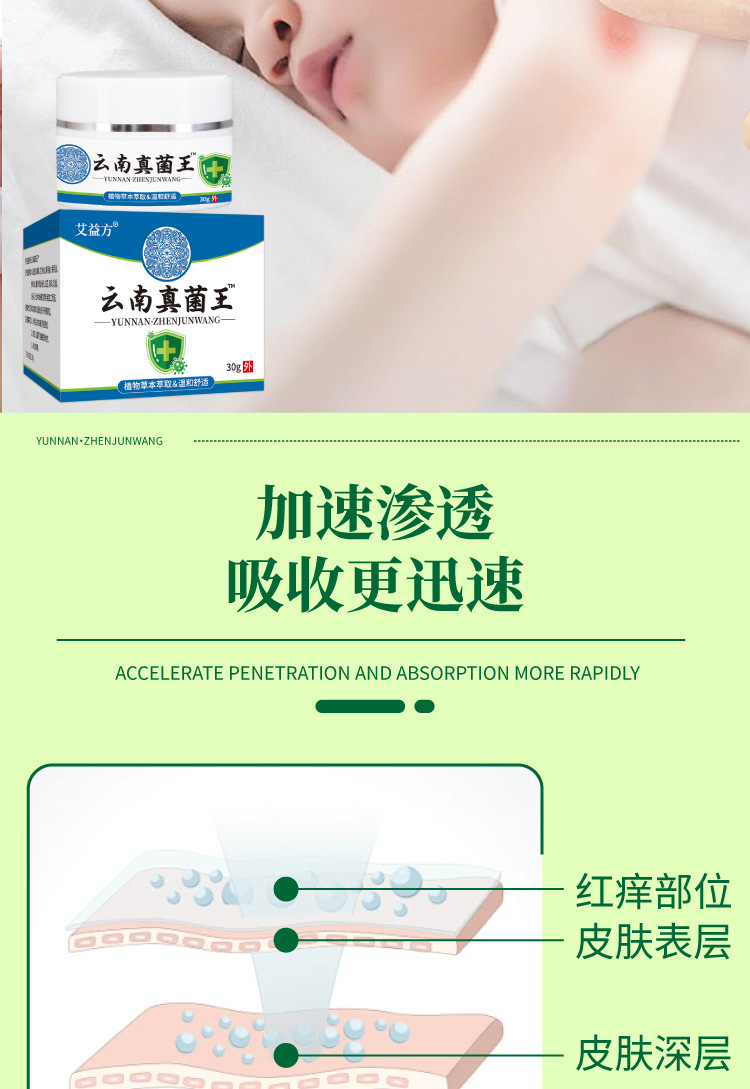 云南真菌王手指起皮粗干裂起硬皮脚后跟防裂膏断痒王皮肤瘙痒批发