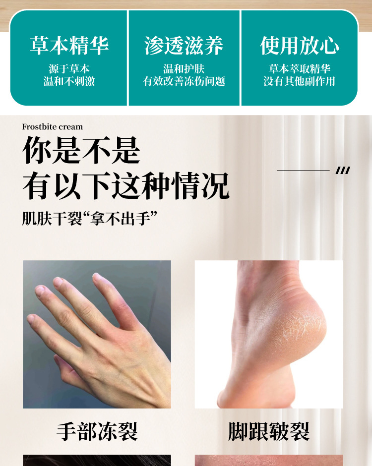 羊毛脂手足修裂膏裂口脱皮疮冻膏修护滋润护手霜冻裂皲裂膏