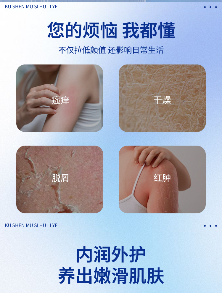 艾益方慕斯皮肤护理液保健液皮肤瘙痒干燥干痒蜕屑艾草喷雾剂厂