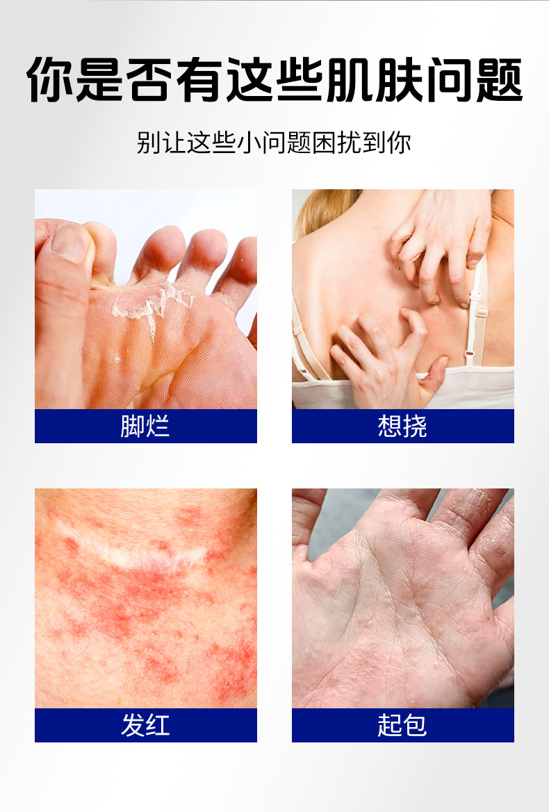 云南本草苗家郎中断痒肤康膏皮肤外用男女通用止痒膏批发脚臭膏
