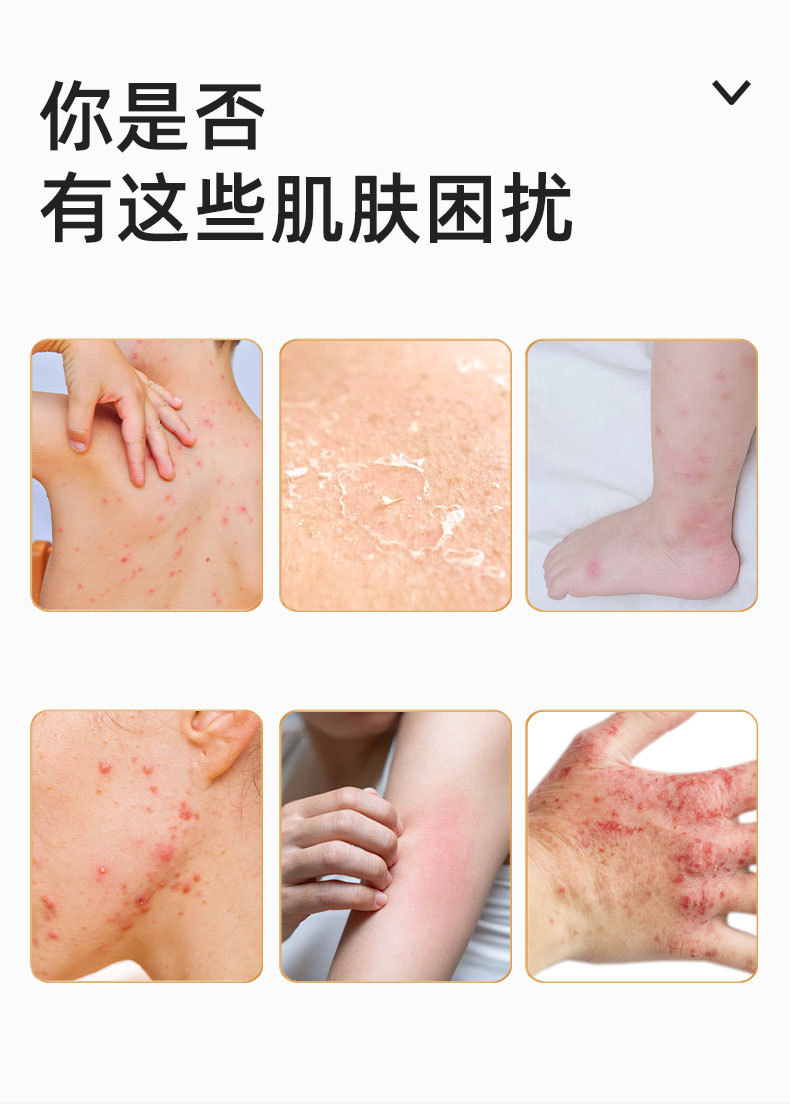 同仁堂硫磺软膏皮肤外用男女通用止痒膏50克大容量硫磺膏乳膏批发