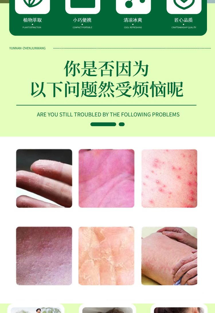 云南真菌王手指起皮粗干裂起硬皮脚后跟防裂膏断痒王皮肤瘙痒批发