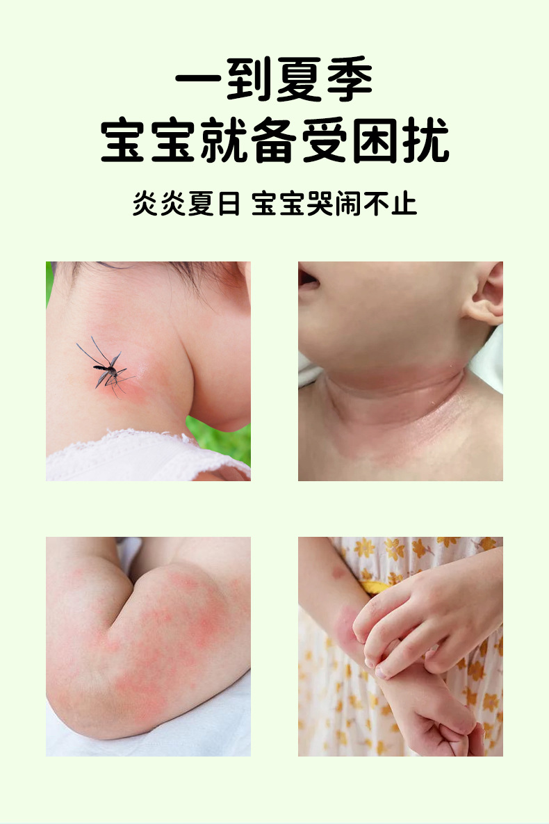 维达熊金银花热痱水儿童夏季清凉舒缓爽肤防叮咬喷雾痱子水批发