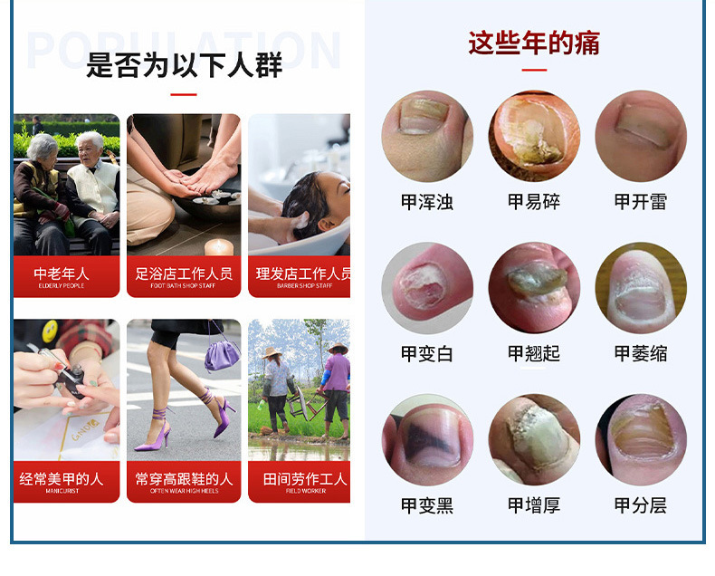 雪槐灰甲清指甲护理脱甲膏软甲草本抑菌液足部护理厂家直销灰指甲