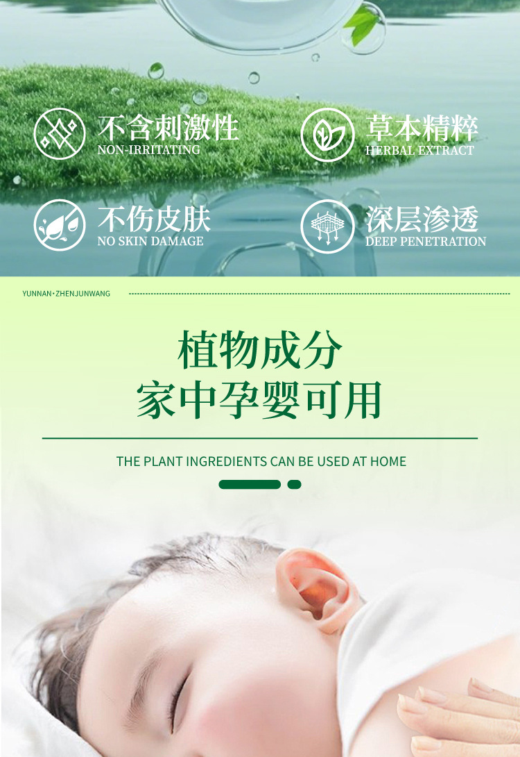 云南真菌王手指起皮粗干裂起硬皮脚后跟防裂膏断痒王皮肤瘙痒批发